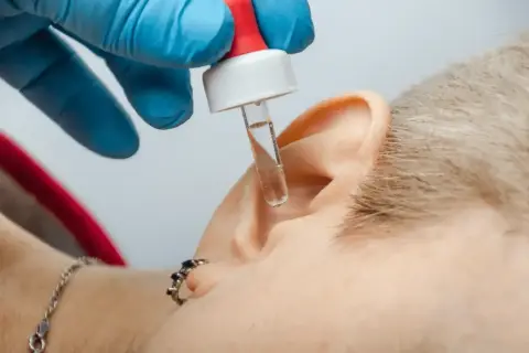 Krople do ucha z pipetki, gdy ropieje ucho od kolczyka. Ręka w niebieskiej rękawiczce aplikuje płyn.