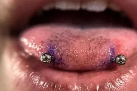 Język z dwoma kolczykami, przypominającymi snake eye piercing. Widać fioletowy ślad po markerze.
