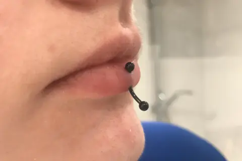 Zbliżenie na usta z czarnym kolczykiem typu vertical labret, który przechodzi pionowo przez dolną wargę.