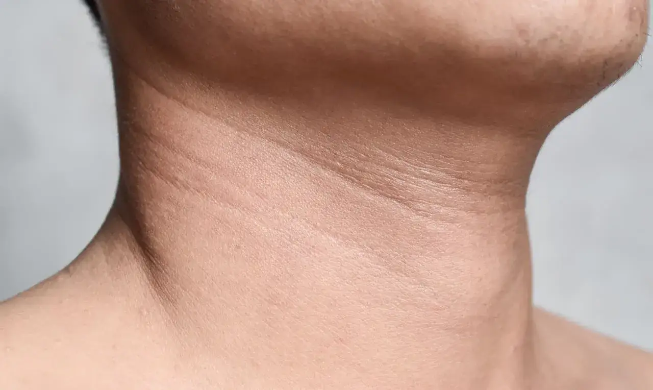 naszyjnik wenus przyczyny tech neck
